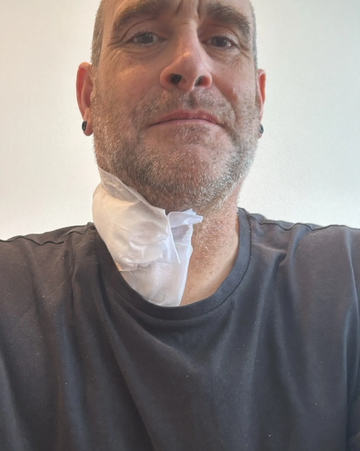 André Flitsch looking into the camera, a white dressing taped over the side of his neck.